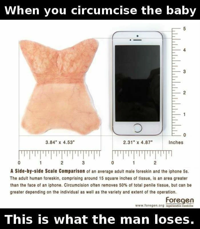 Scale comparison illustrating adult foreskin tissue size relative to everyday objects.