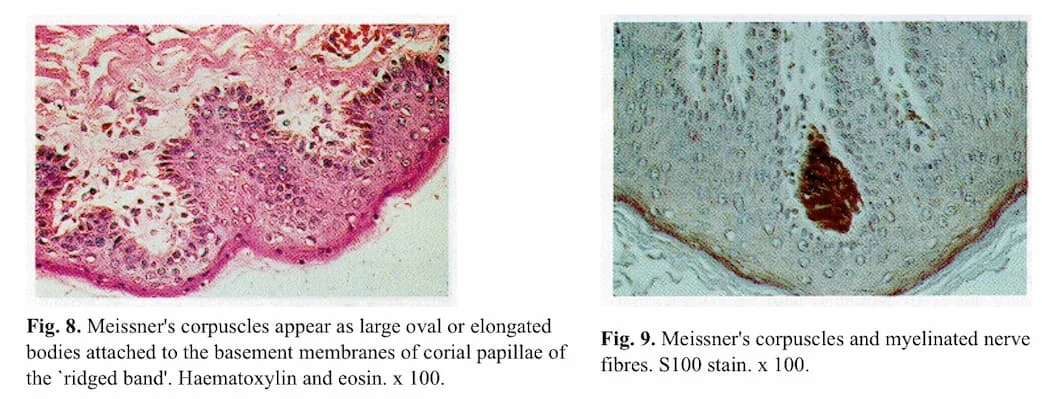 Histology images showing Meissner’s corpuscles and nerve structures in preputial tissue (Taylor, Lockwood & Taylor; Cold & Taylor).