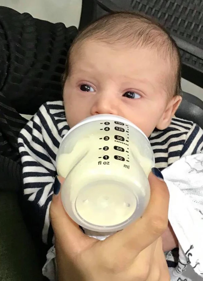 Newborn with puffy reddened eyes and tightly clenched hands consistent with acute distress.