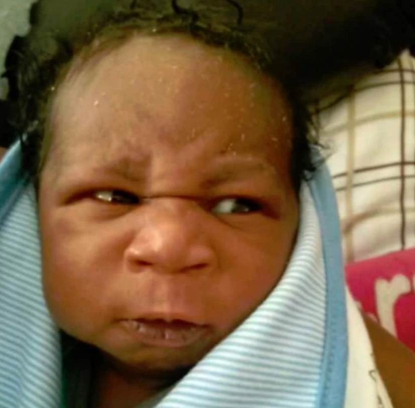 Neonate showing visible distress with facial tension and eye squeeze.