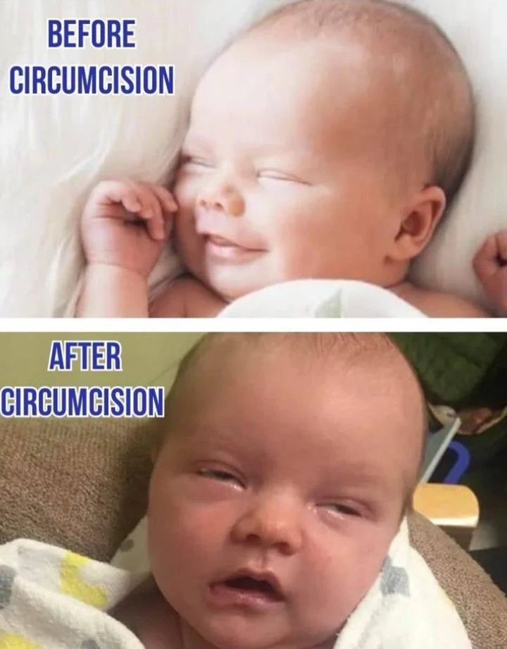 Newborn appearing shut down or withdrawn after acute stress.
